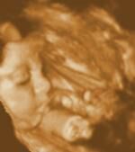 Klik op de afbeelding om de link te volgen